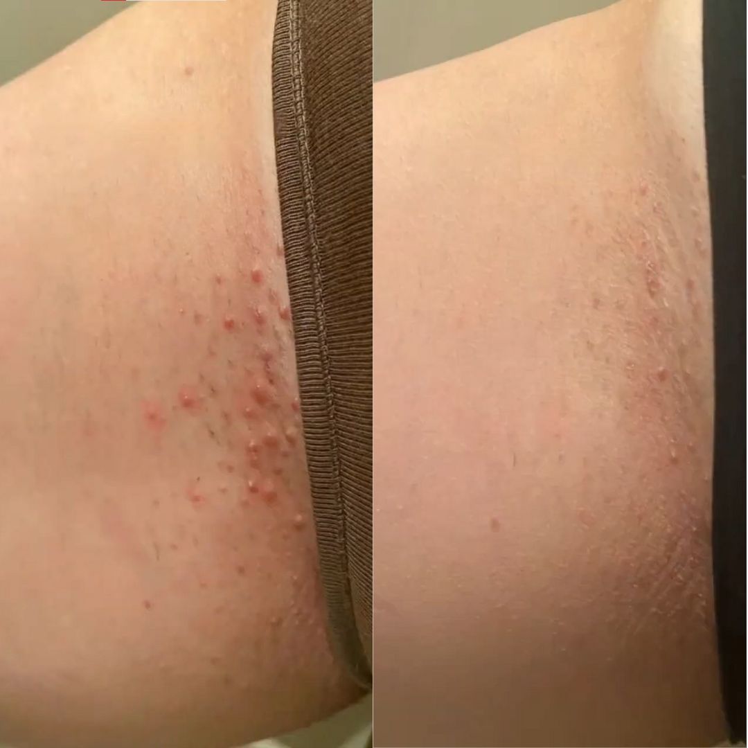 Barelle Cyperus Rotundus skin serum