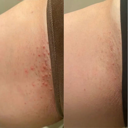 Barelle Cyperus Rotundus skin serum